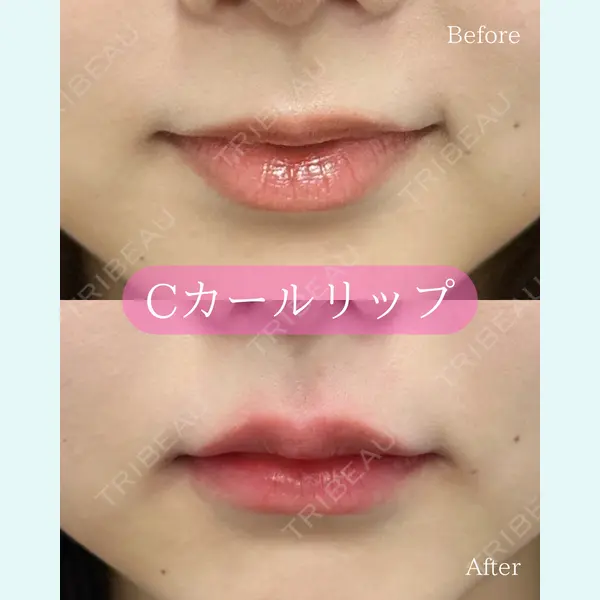 ルラ美容クリニック 郡山院 横瀬 晃平医師の症例