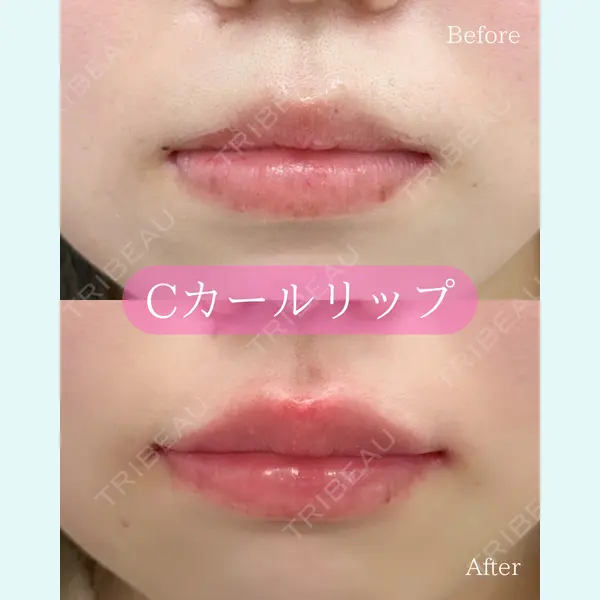 ルラ美容クリニック 郡山院の症例