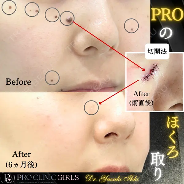 PRO CLINIC プロクリニック 銀座院 柚﨑 一輝医師の症例