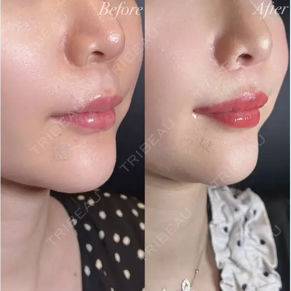 R Beauty CLINIC 銀座院 村山史朗医師の症例