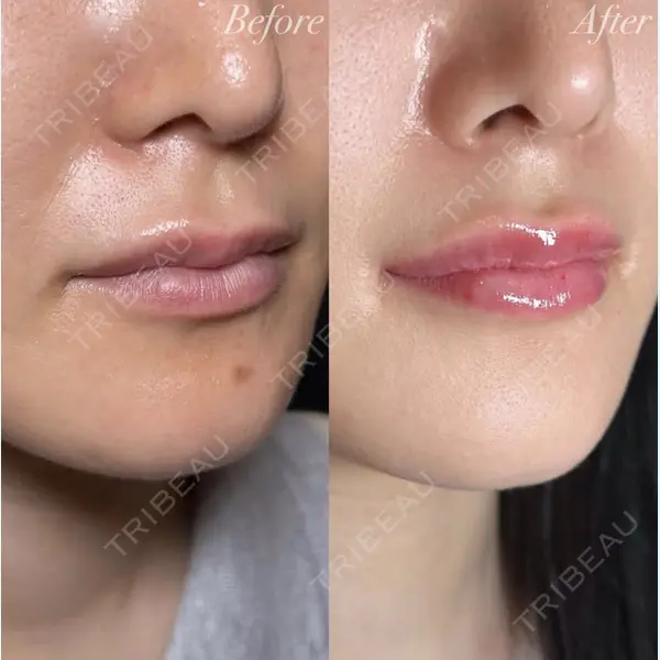 R Beauty CLINIC 銀座院 村山史朗医師の症例