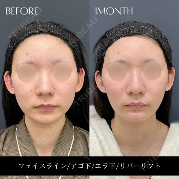 RIVER CLINIC（リバークリニック）の症例