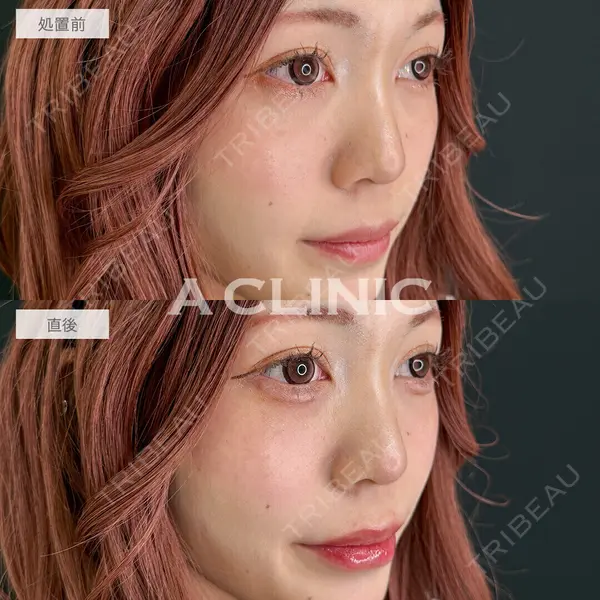 A CLINIC（エークリニック） 池袋院 三橋 克之医師の症例