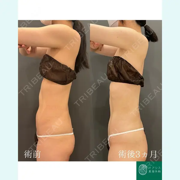 オアシス美容外科 遠藤 剛史医師の症例