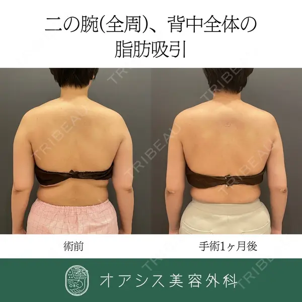 オアシス美容外科 遠藤 剛史医師の症例