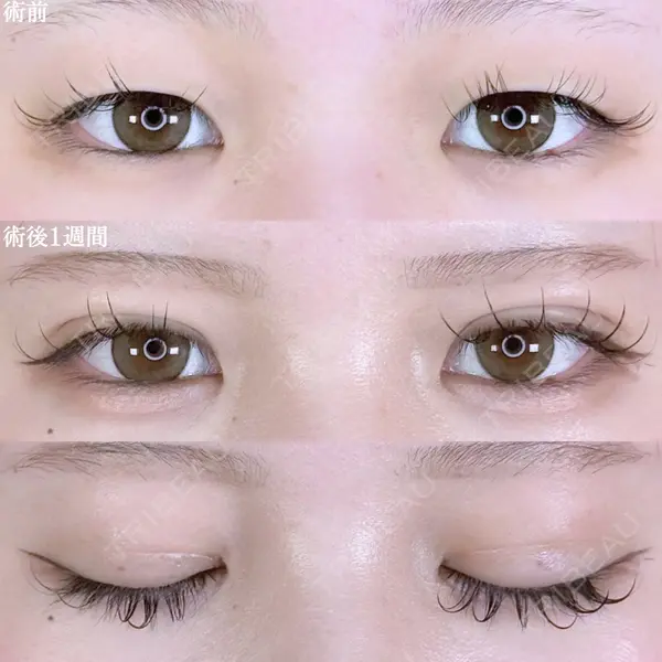 アリエル美容クリニック 郡山院 安齋 誠基医師の症例