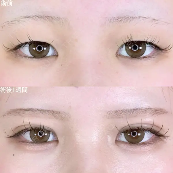 アリエル美容クリニック 郡山院 安齋 誠基医師の症例