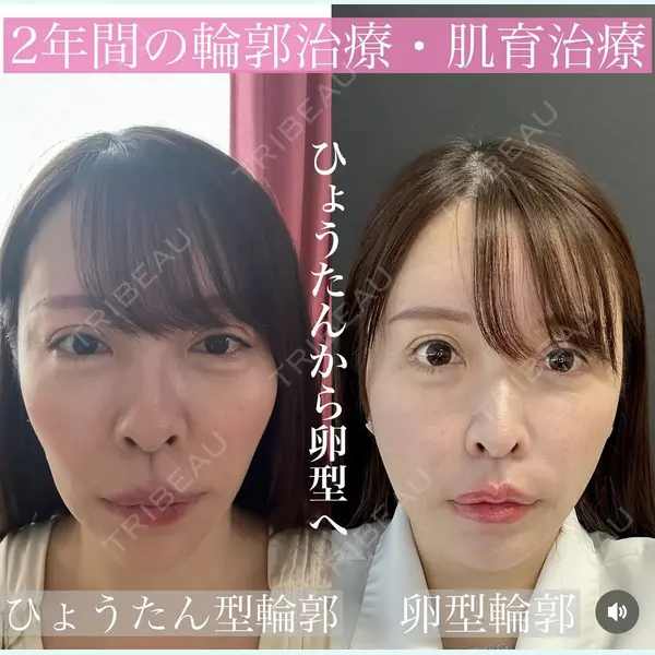 ルラ美容クリニック 渋谷本院 昼間 路子医師の症例