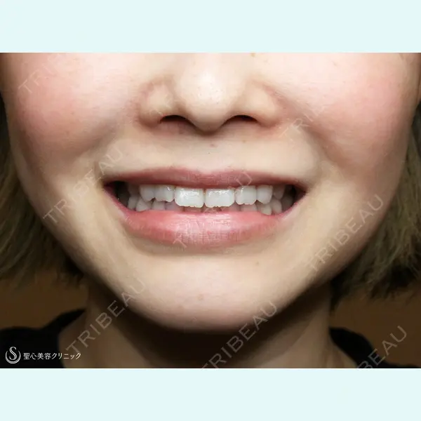 聖心美容クリニック 札幌院 前多 一彦医師の症例