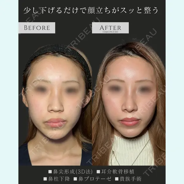 eクリニック 名古屋院 服部 健人医師の症例