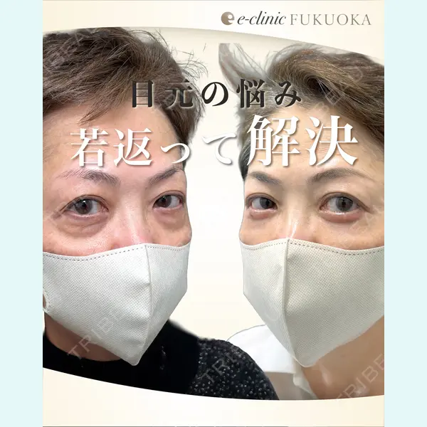 eクリニック 福岡院 伊藤 渉医師の症例