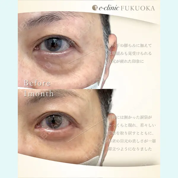 eクリニック 福岡院 伊藤 渉医師の症例