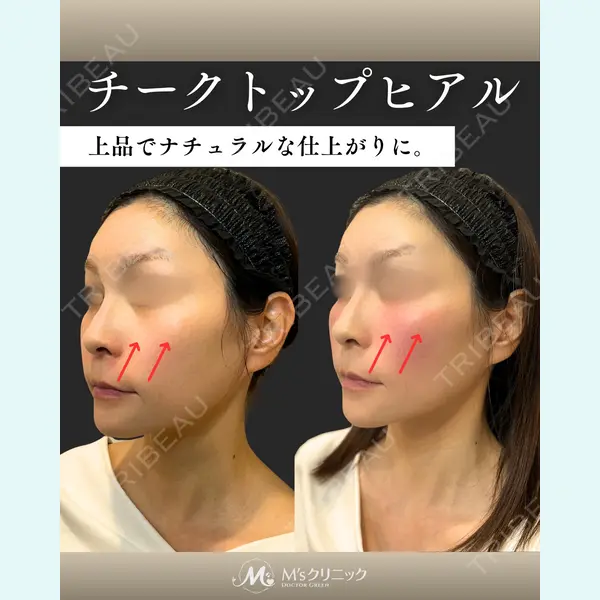 M'sクリニック【エムズクリニック】 谷口 緑医師の症例