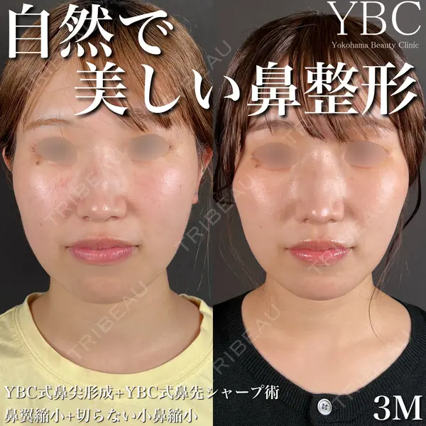 YBC横浜美容外科 大宮院 磯村 亮輔医師の症例