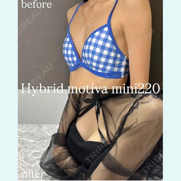 plume clinic 向山 綾子医師の症例