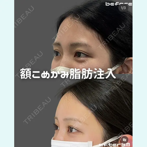 plume clinic 向山 綾子医師の症例