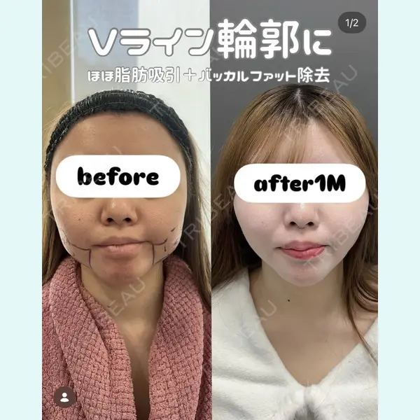 plume clinic 向山 綾子医師の症例