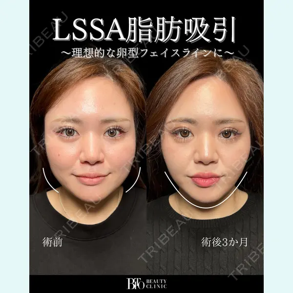 BITO BEAUTY CLINIC 伊藤 富良野医師の症例