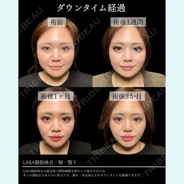 BITO BEAUTY CLINIC 伊藤 富良野医師の症例