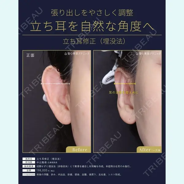 聖心美容クリニック 広島院 中辻 隆徳医師の症例