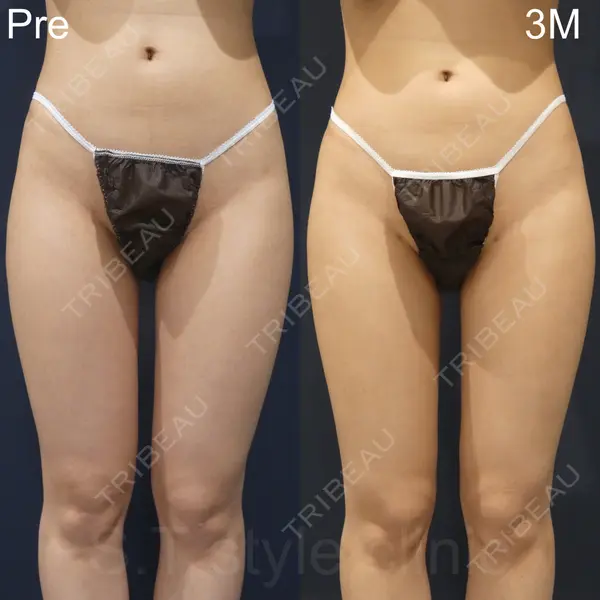 S.T styleクリニック 徳田 真紀子医師の症例