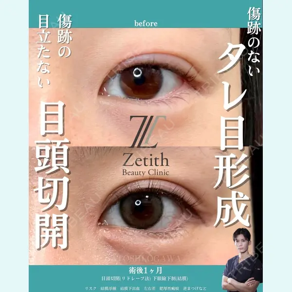 Zetith Beauty Clinic 銀座院 小川 悟史医師の症例