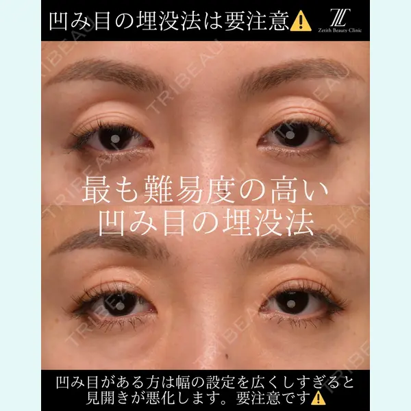 Zetith Beauty Clinic 大阪心斎橋院の症例