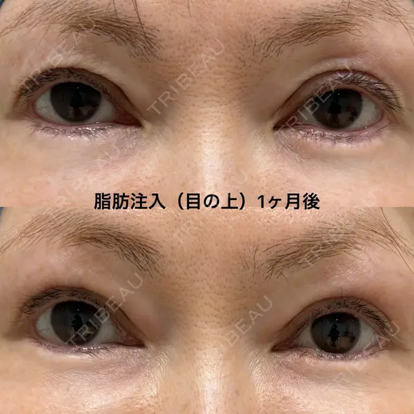 エターナル美容クリニック 久門田 詳医師の症例