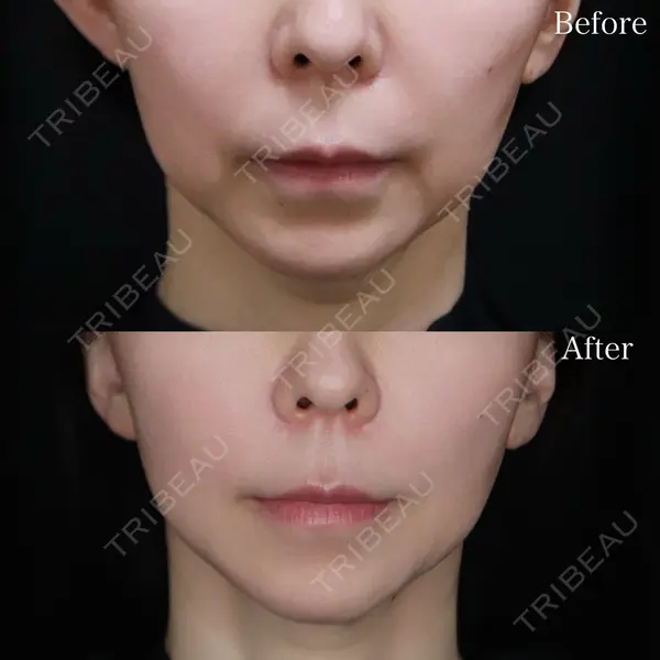 Wクリニック 福岡院 堂園 史子医師の症例