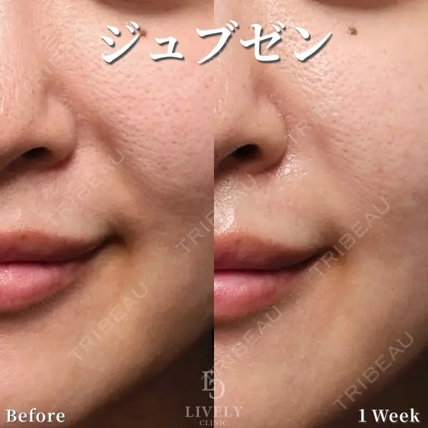 ライブリークリニック 大阪院の症例