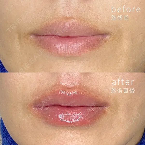 ミニマムスキンクリニック銀座の症例