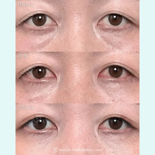 博多もへじのクリニック 村田 将光医師の症例