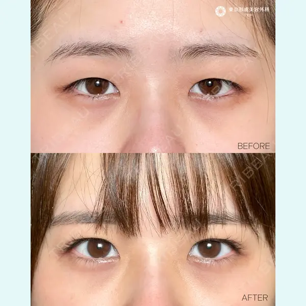 東京形成美容外科 船橋院 山崎 修吾医師の症例