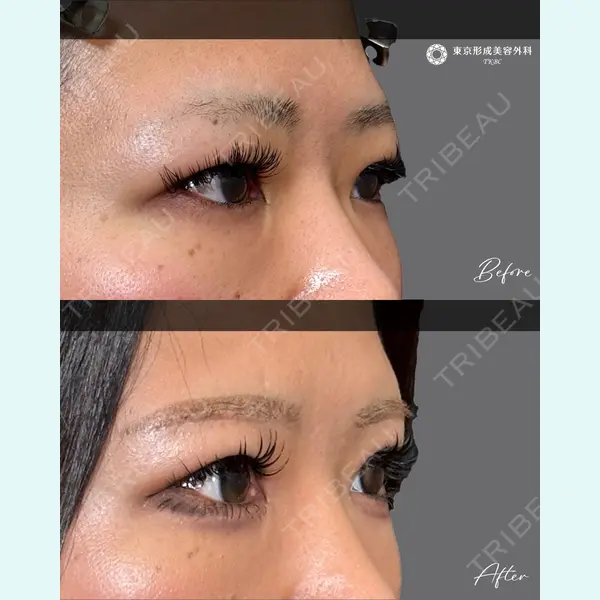 東京形成美容外科 池袋院 弓削田　浩主医師の症例