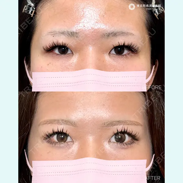 東京形成美容外科 池袋院 弓削田　浩主医師の症例