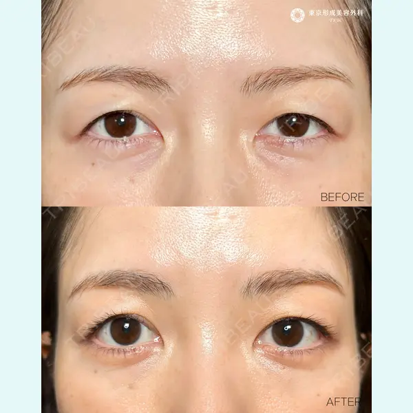 東京形成美容外科 船橋院 山崎 修吾医師の症例