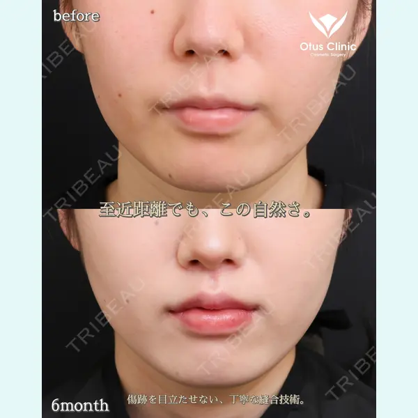 Otus Clinic 【オータスクリニック】 中 徳太郎医師の症例