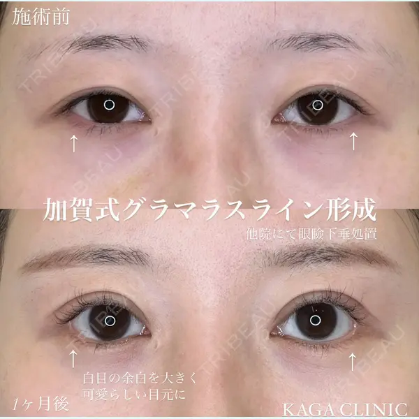 KAGA CLINIC 加賀 裕基医師の症例