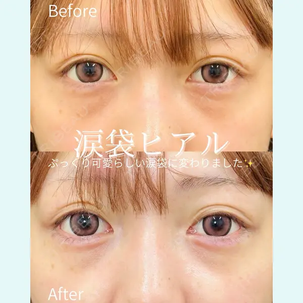 ルラ美容クリニック 仙台院 / ルラスキンクリニック 仙台院 橋本 英樹医師の症例