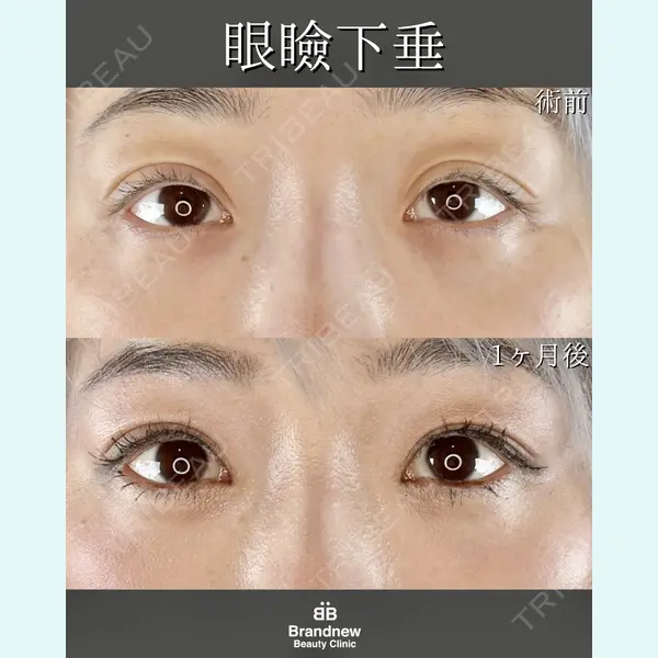 Brandnew Beauty Clinic 平山 容成医師の症例