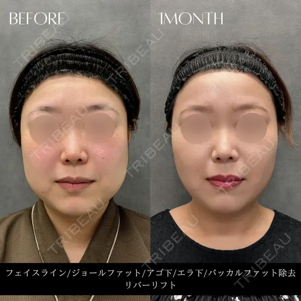 RIVER CLINIC（リバークリニック）大阪院の症例