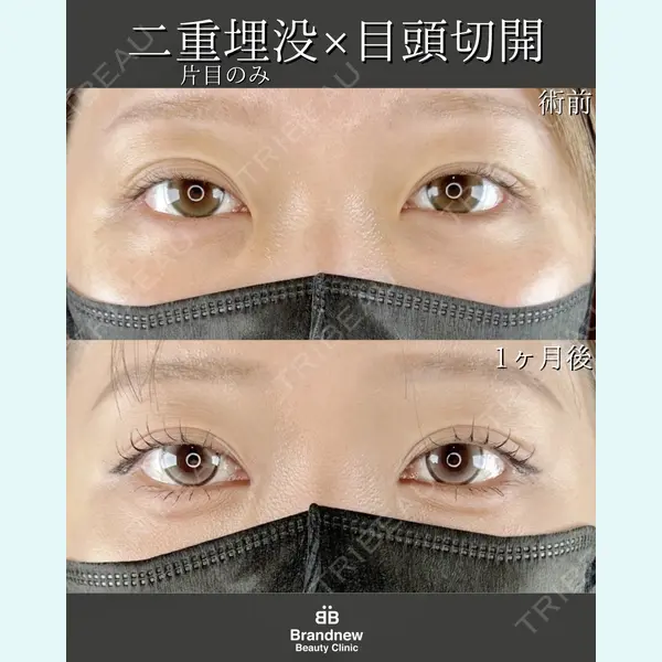 Brandnew Beauty Clinic 平山 容成医師の症例