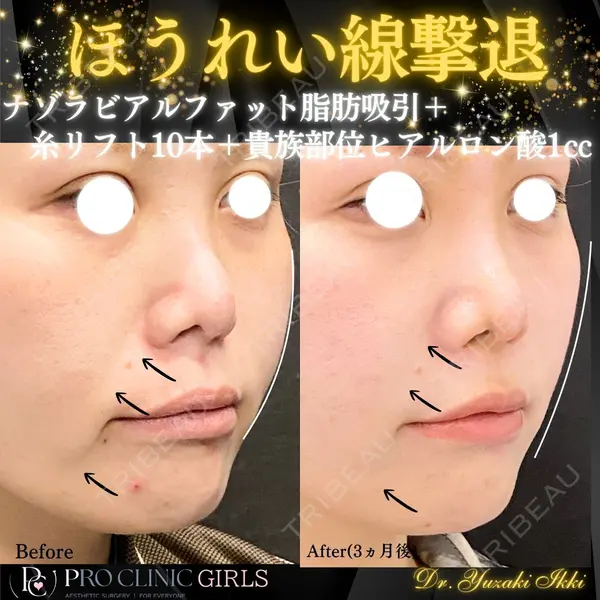 PRO CLINIC プロクリニック 銀座院 柚﨑 一輝医師の症例