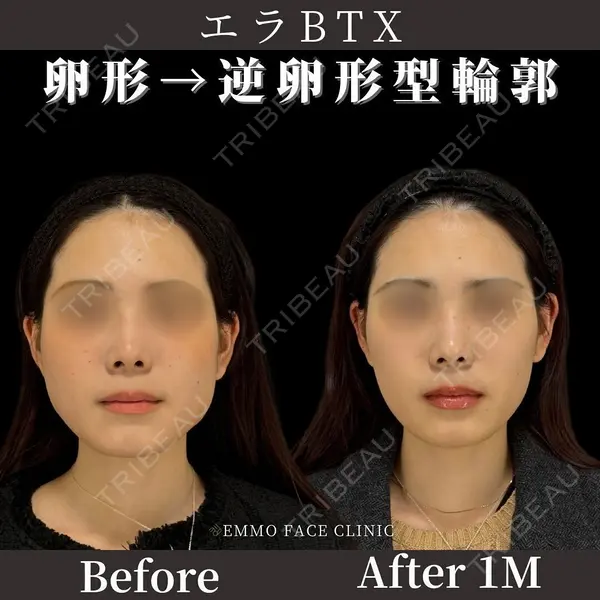EMMO FACE CLINIC 東京三田院 木之下 哲彦医師の症例