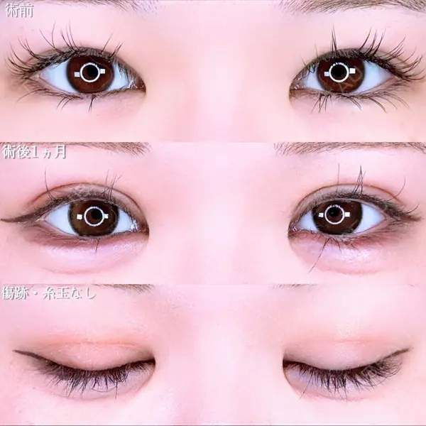 アリエル美容クリニック 水戸院 天白 典秀医師の症例