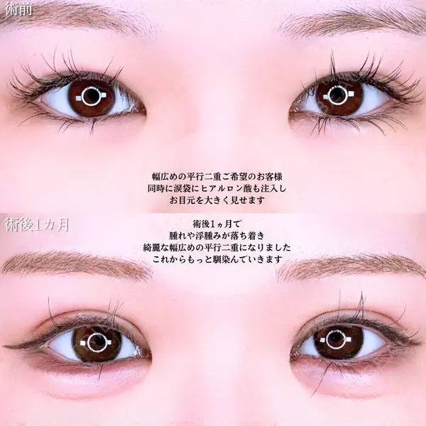 アリエル美容クリニック 水戸院 天白 典秀医師の症例