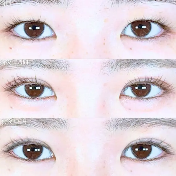 アリエル美容クリニック 大宮院 江郷隼一郎医師の症例