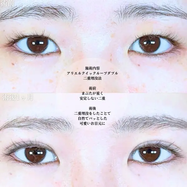 アリエル美容クリニック 大宮院 江郷隼一郎医師の症例