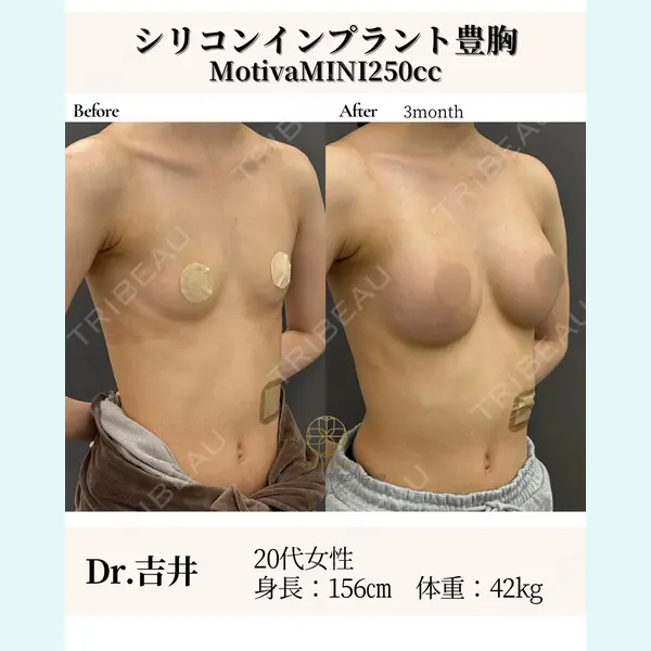 お茶の水美容形成クリニック 吉井 健吾医師の症例