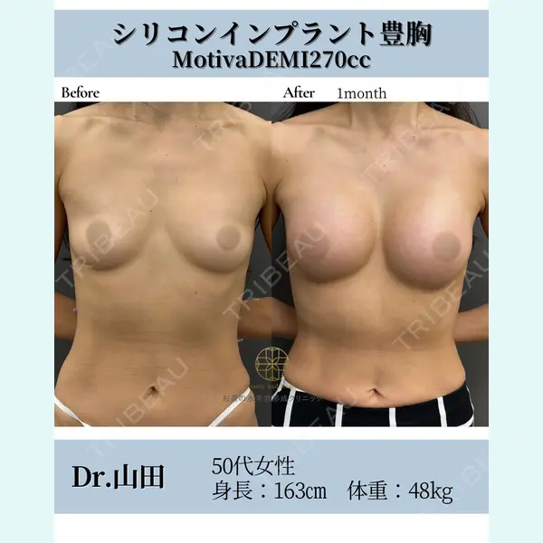 お茶の水美容形成クリニック 山田 淳生医師の症例